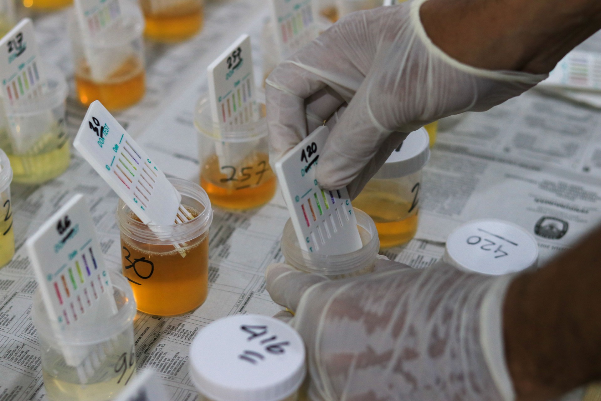 Urine Test Kit: Rapid Detection for Drug Abuse